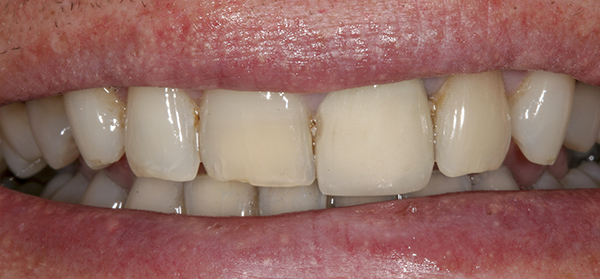 Smile Gallery - Before