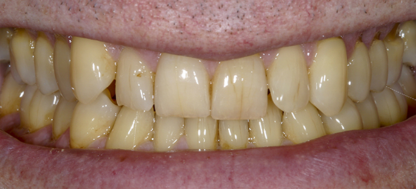 Smile Gallery - Before