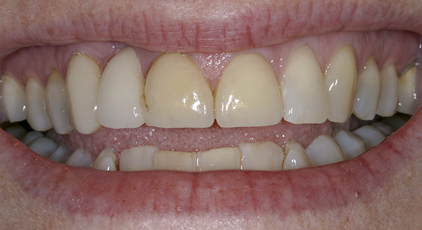 Smile Gallery - Before