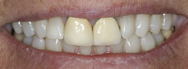 Smile Gallery - Before