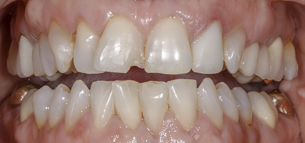 Smile Gallery - Before