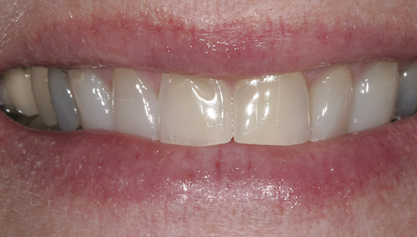 Smile Gallery - Before